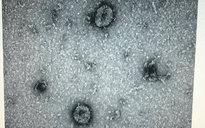 Khẩn trương giải mã virus SARS-CoV-2 gây bệnh ở Hải Dương, tìm nguồn liên quan