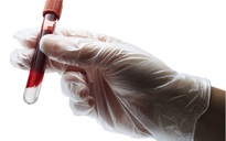 6 xét nghiệm máu cần thiết bạn nên làm