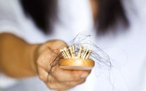 5 lý do khiến tóc mỏng đi có thể khiến bạn bất ngờ
