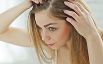 Những lý do khiến tóc rụng sẽ làm bạn bất ngờ