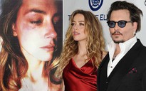 'Cướp biển' Johnny Depp bị vợ cũ bạo hành?