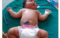 Bé gái sơ sinh nặng 6,81 kg ở Ấn Độ