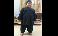 7 tuổi nặng 120 kg, cậu bé phải cắt bỏ 75% dạ dày để giảm cân