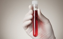 Phương pháp xét nghiệm máu mới giúp phát hiện sớm 8 loại ung thư