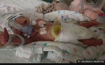 Cô bé sinh non 5 ngày tuổi và ca phẫu thuật nghẹt thở