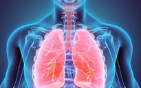 Cách phân biệt triệu chứng viêm phổi và viêm phế quản