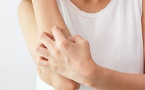 4 nguyên nhân phổ biến khiến da bỗng dưng bị bong tróc
