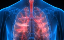 Người đàn ông Mỹ 'dùng' 6 lá phổi trong hơn 2 năm