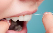 4 kiểu dùng chỉ nha khoa sai gây hại cho răng nướu