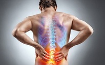 Phải làm gì để giảm đau lưng dưới hiệu quả?