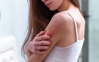 5 dấu hiệu của da quá nhạy cảm và cách khắc phục