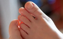 Chuyến đi làm nail kinh hoàng của một phụ nữ