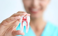 Điều gì sẽ xảy ra với răng khi bạn lấy tủy ?