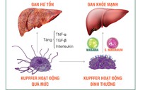 Gan kêu cứu vì thực phẩm bẩn