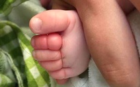 Em bé sơ sinh suýt mất 4 ngón chân chỉ vì một sợi tóc của mẹ