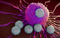 Truyền tế bào miễn dịch vào người bệnh để điều trị ung thư