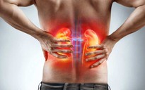 Cách nhận biết cơn đau lưng của bạn là bệnh thận