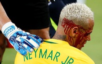 Đối phương từ chối xin lỗi và bài học cho Neymar