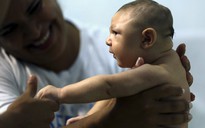 WHO: Virus Zika gây ra tật đầu nhỏ ở trẻ sơ sinh