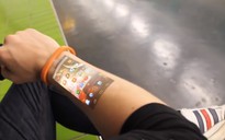 Chế tạo thành công smartwatch phóng to màn hình lên da