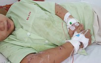 TP.HCM: Truy tố 3 bị can tra tấn cô gái 18 tuổi đến sẩy thai