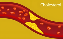 Ngày mới với tin tức sức khỏe: Ăn uống thế nào để mức cholesterol không tăng cao?