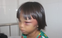 Bé gái 7 tuổi nhập viện với hàng loạt vết thương bất thường