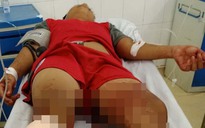 Điều tra vụ nam thanh niên ở Tây Ninh bị chém đứt lìa chân