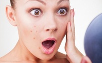 Nổi nhiều mụn trên mặt do da quá nhờn, phải điều trị bằng cách nào?