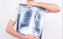 Người phụ nữ được phát hiện ung thư phổi nhờ... bàn tay ‘nhung’