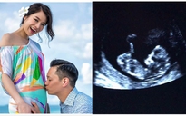 Hồ Hạnh Nhi công bố mang thai nhân Ngày của mẹ