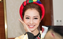 Hoa hậu Jennifer Phạm nhập viện cấp cứu vì ngã trên sân khấu