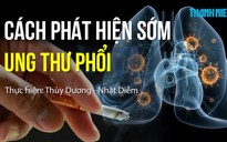 Cách phát hiện sớm ung thư phổi