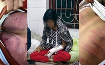 Con gái 14 tuổi bị bố đẻ đánh đến nhập viện cấp cứu