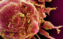 Cảnh báo virus gây Covid-19 có thể biến đổi chức năng tế bào