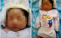 Sản phụ có con ‘ruột trào khỏi bụng’ tố bệnh viện khiến trẻ chết oan