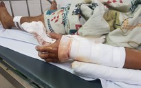 Bình Định: Điều tra vụ con rể chém cha vợ và anh vợ bị thương