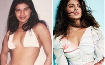 Hoa hậu Thế giới Priyanka Chopra gây sốc với ảnh thời chưa 'dao kéo'