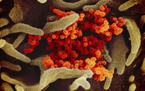 Virus Corona lây nhiễm nhiều nhất trong tuần đầu tiên bệnh nhân phát triệu chứng