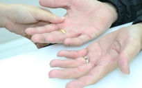 Phòng dịch Covid-19: Rửa tay diệt khuẩn, làm sao để không bị khô da tay?