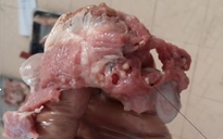 Phát hiện ổ bệnh sán dây lợn (lợn gạo) ở Bình Phước