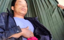 Quảng Trị: Một người ở xã Húc bị trâu húc thủng bụng