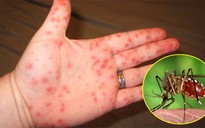 Đắk Lắk: Một bệnh nhi tử vong do sốt xuất huyết