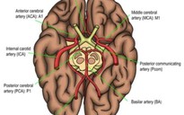 Bác sĩ bị điều tra vì không cứu kịp bệnh nhân bị đột quỵ hiếm gặp