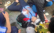 Thừa Thiên - Huế: Một nữ sinh bị người đàn ông dùng búa đánh chấn thương