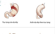 Bệnh xoắn dạ dày ở trẻ nhỏ