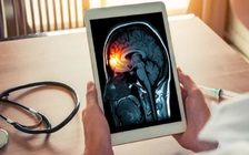 Viêm màng não do vi khuẩn và virus khác nhau như thế nào?