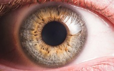 Chàng trai suýt mù vì bị ký sinh trùng đục khoét mô mắt