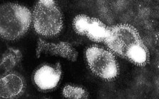 Campuchia phát hiện thêm 12 ca nghi nhiễm H5N1 sau khi một bé gái tử vong