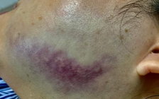 Quảng Ninh: Nữ công chứng viên bị người đàn ông nhổ nước bọt, đá sưng mặt